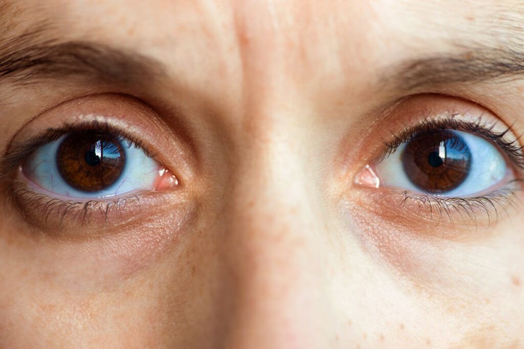 Scared eyes