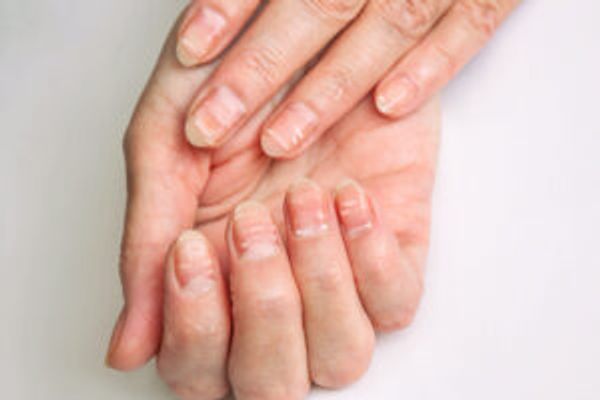 Nails with white lines