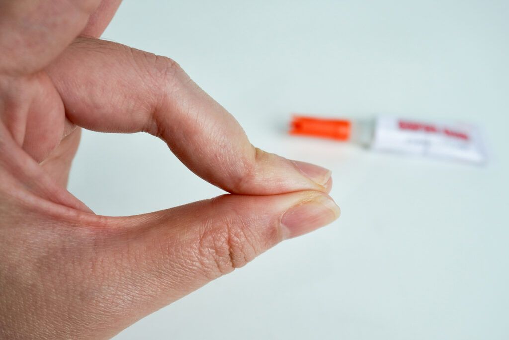 Fingers stuck together with superglue