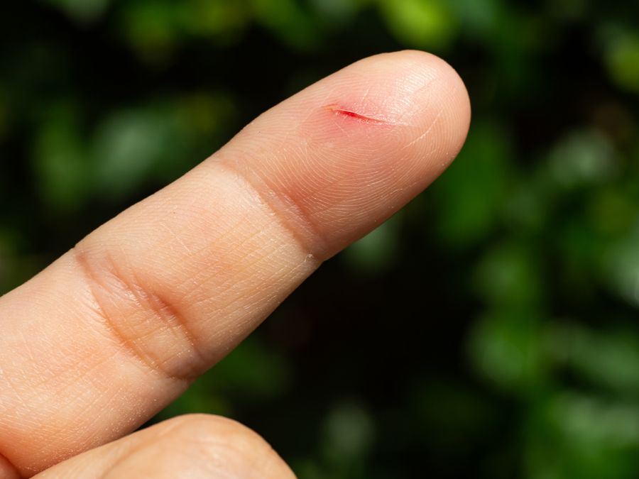 Why Do Paper Cuts Hurt So Much?