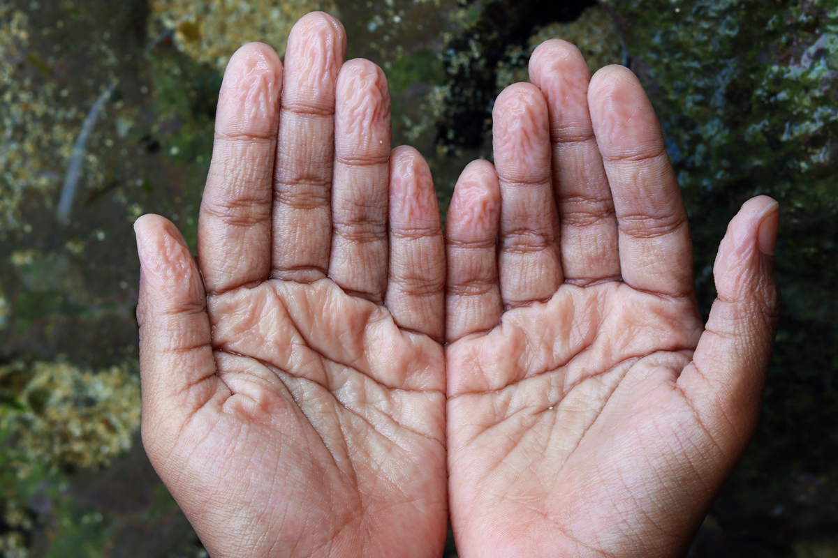 Pruney fingers