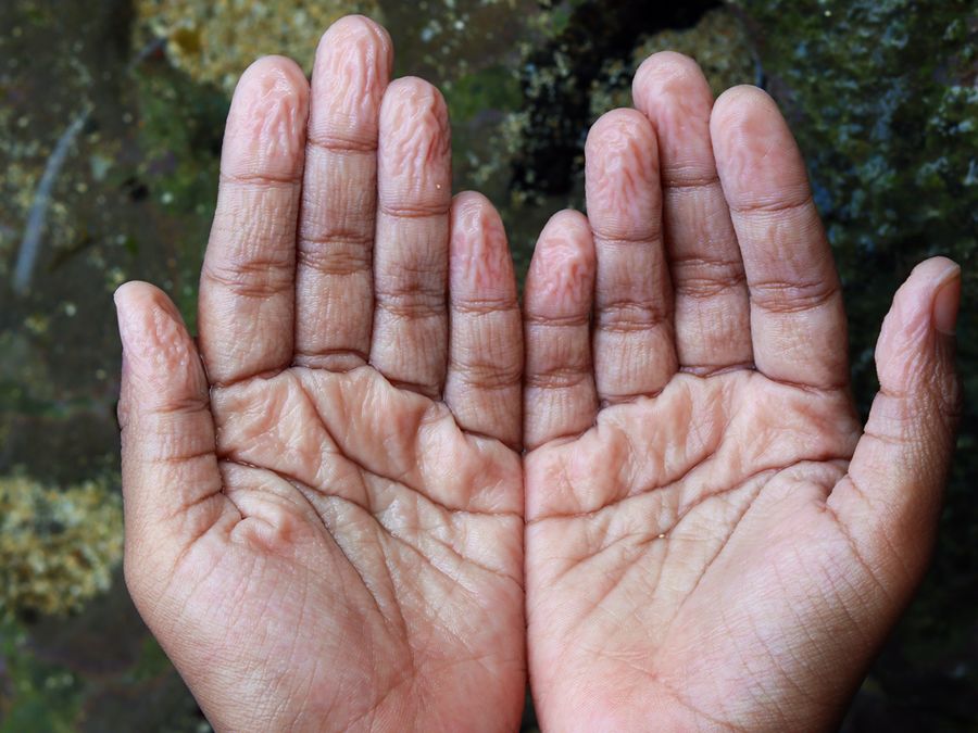 Pruney fingers