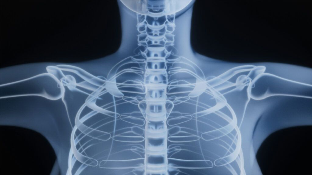 X-ray of human from chin to chest