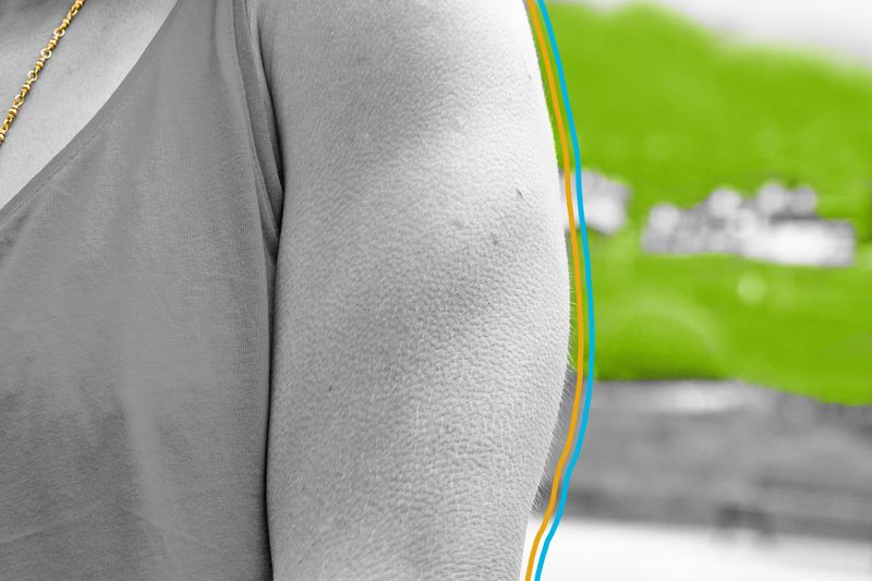 Close-up of goosebumps on a woman's shoulder