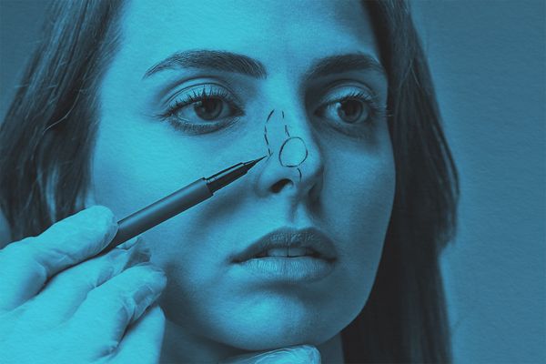 Why Is It Called ‘Plastic Surgery’?